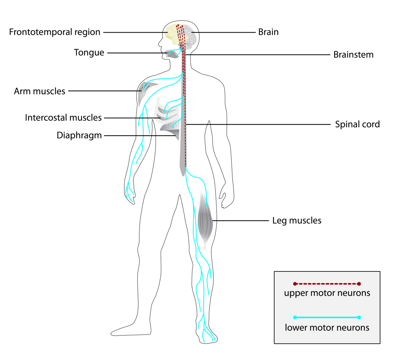 Diagram of the areas affected by ALS