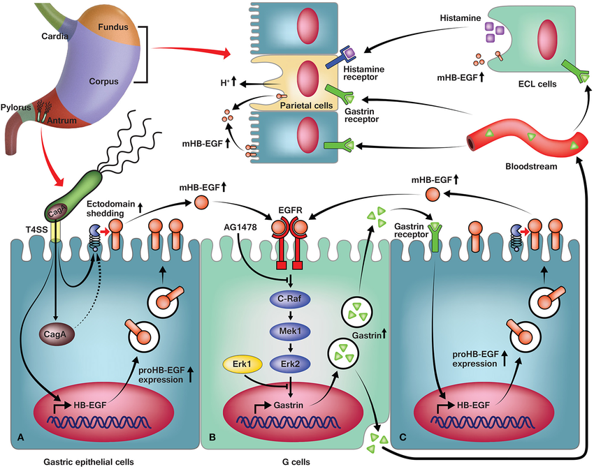 Modelo de expresión de gastrina inducida por H. pylori