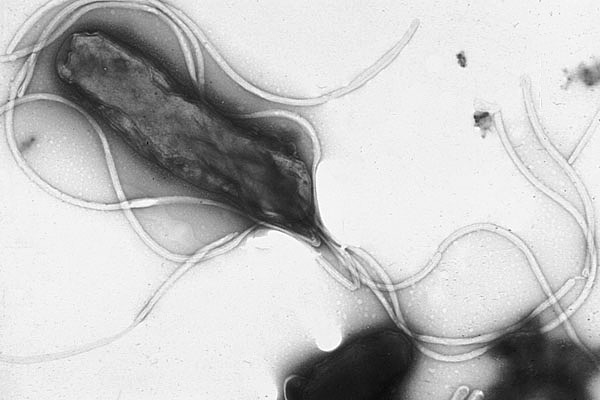 Micrografía electrónica de Helicobacter pylori