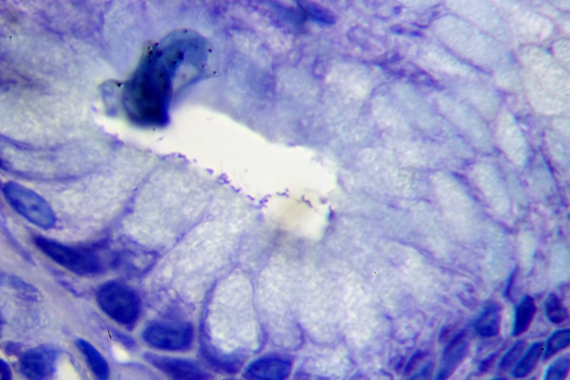 Gastritis por H. pylori en tinción H&E — lámina 7