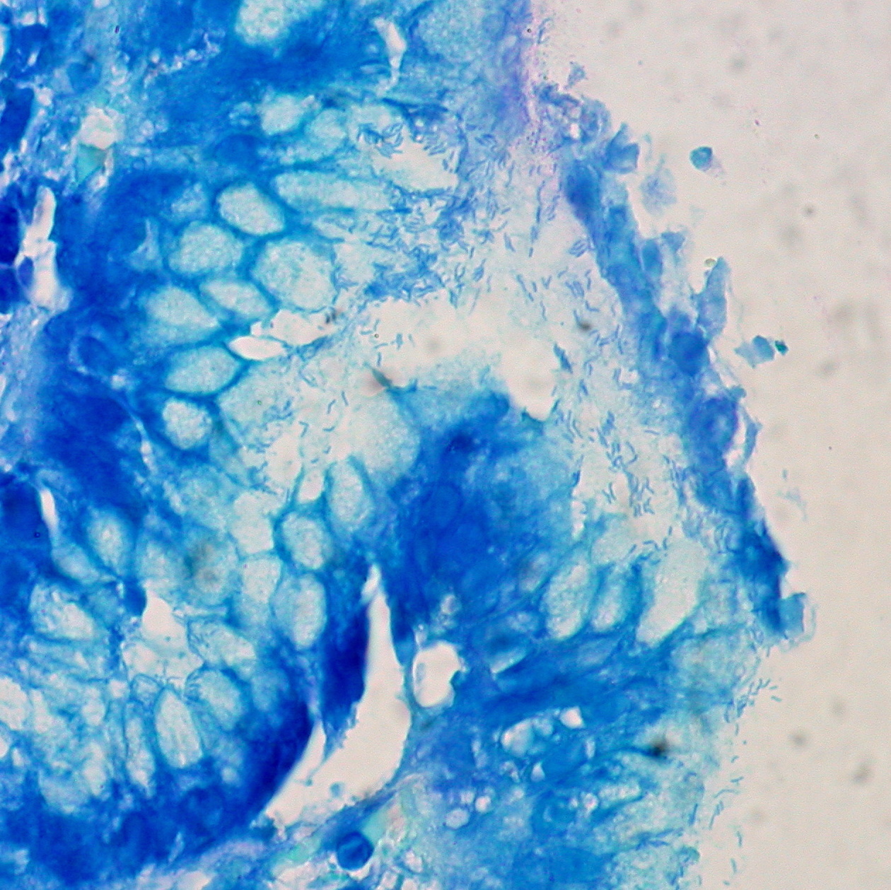 Biopsia de estómago con H. pylori en tinción Giemsa