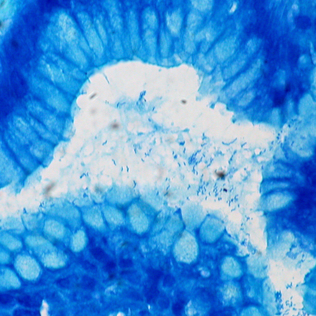 Biopsia gástrica con H. pylori en tinción Giemsa