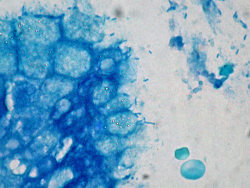 H. pylori en mucosa gástrica con tinción Giemsa