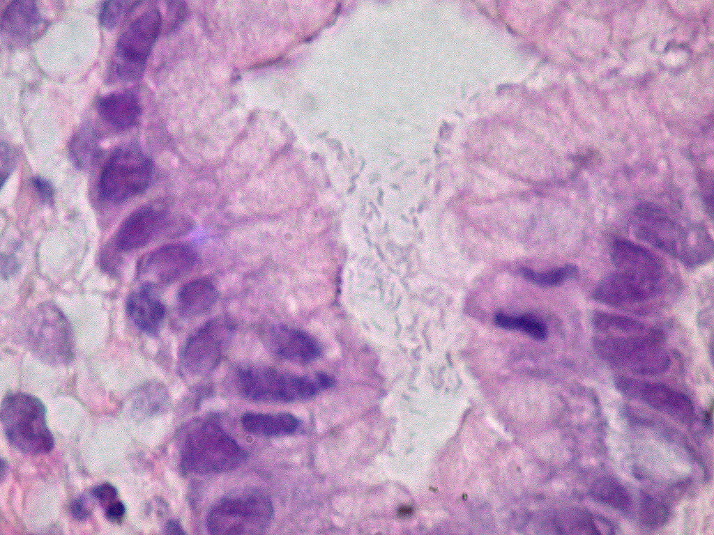 Mucosa gástrica con H. pylori en tinción H&E