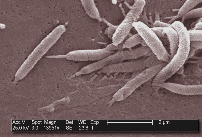 Helicobacter pylori visto al microscopio